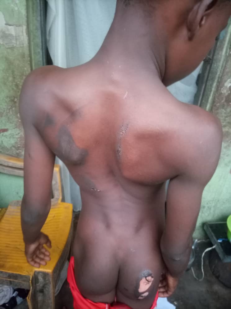 Woman in Calabar uses electric iron on stepson for misplacing N200