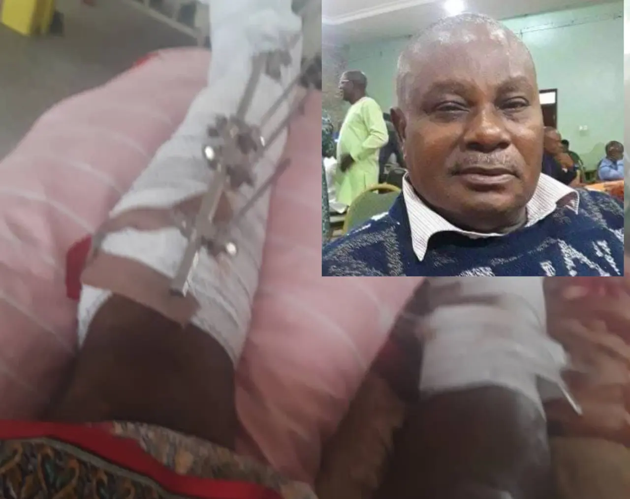 Journalist hit by reckless driver in Calabar needs help