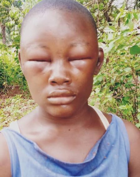 Anambra Woman Arrested For Torturing Housemaid over Alleged Theft