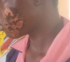 Police arrest woman for allegedly inflicting injuries on her 17-year-old maid